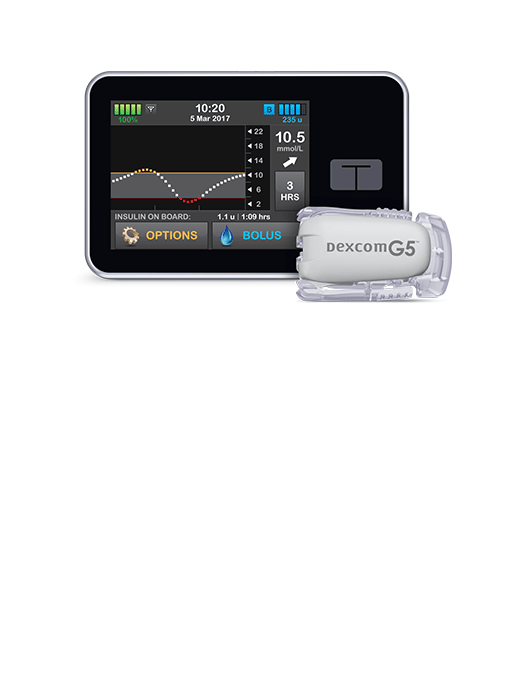 T slim and dexcom g4