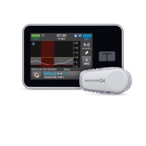 dexcom amsl