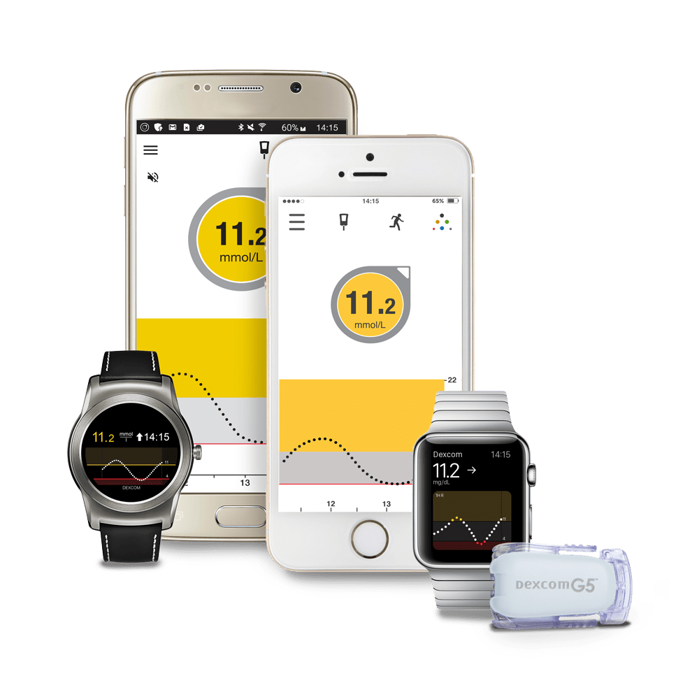 dexcom smartwatch