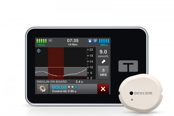 t:slim Control-IQ and the all-in-one Dexcom CGM sensor